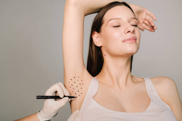 Botox for excessive sweating (hyperhidrosis) in Izmir performed by a dermatologist