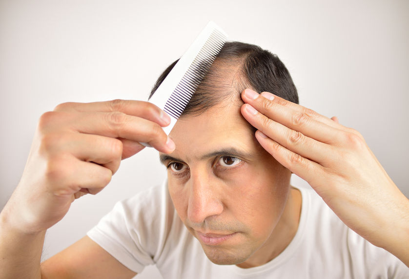 Erkeklerde Saç Dökülmesi – Dermatolog İzmir