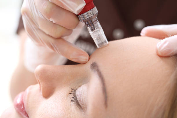 İzmir Dermapen uygulamaları ile cilt yenileme, kırışıklık ve leke tedavisi uzman dermatolog tarafından