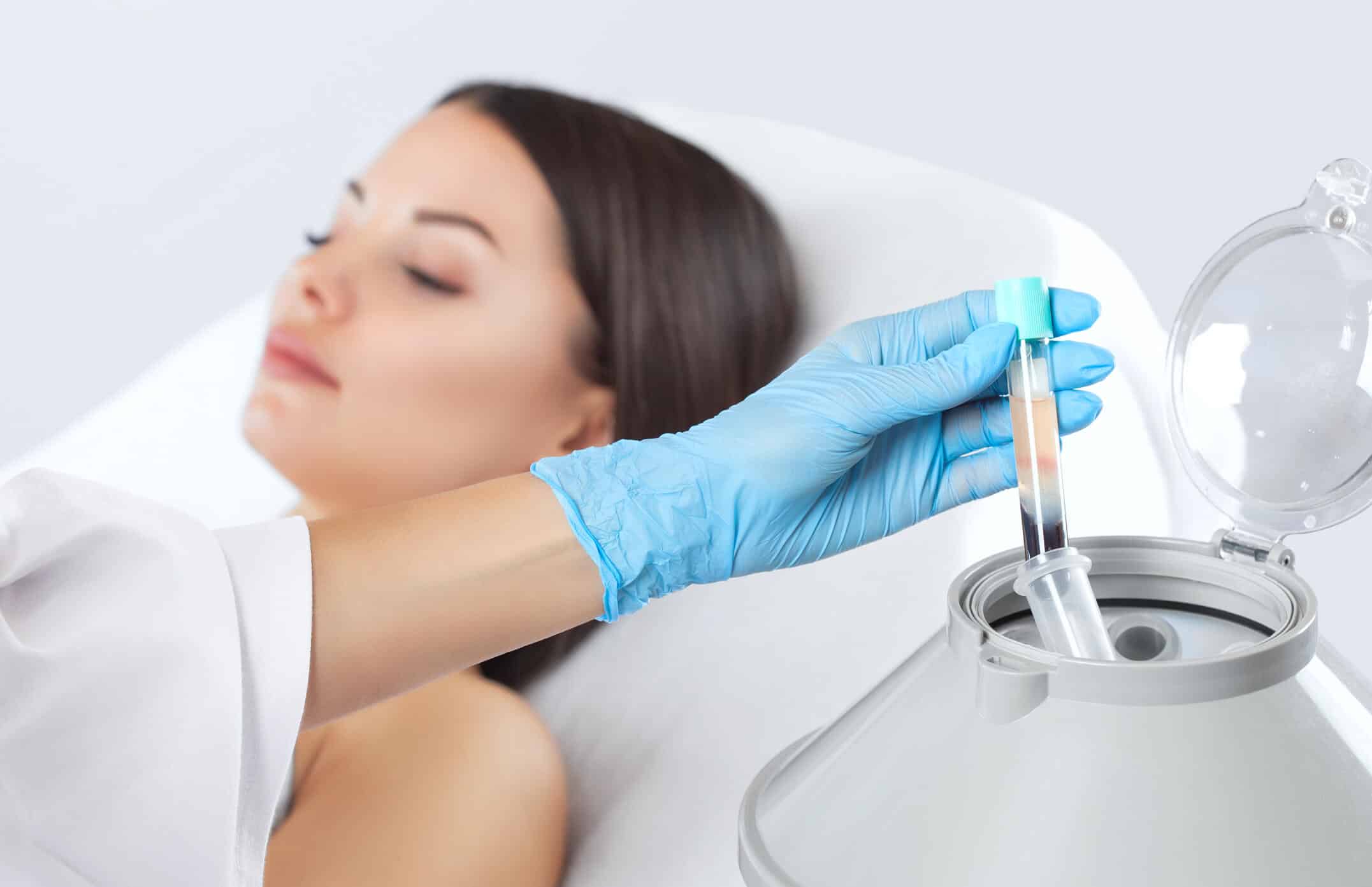 İzmir PRP uygulamaları ile cilt yenileme, saç tedavisi ve kırışıklıklar uzman dermatolog tarafından