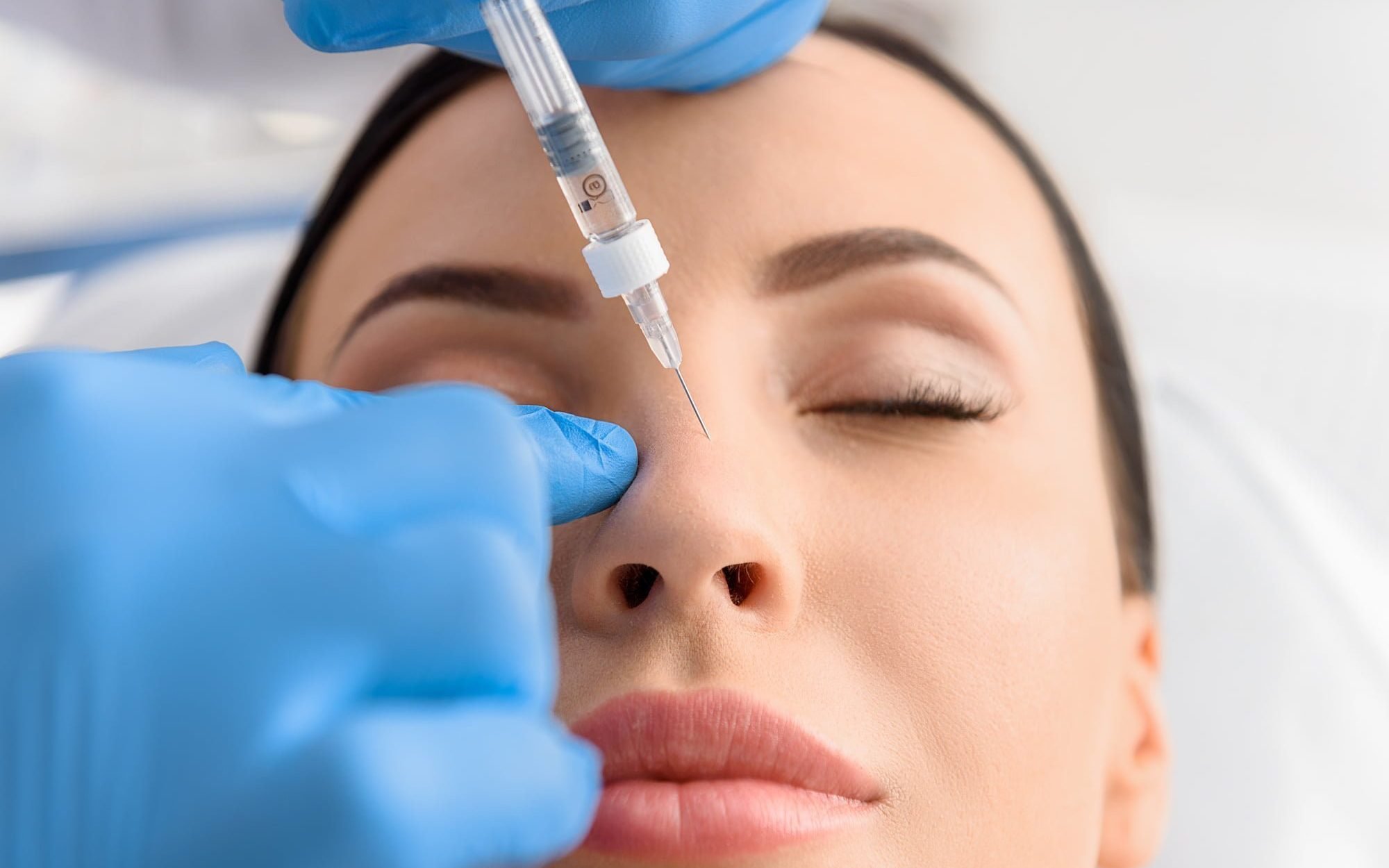 Nose filler treatment in Izmir using hyaluronic acid for non-surgical nose shaping performed by a dermatologist