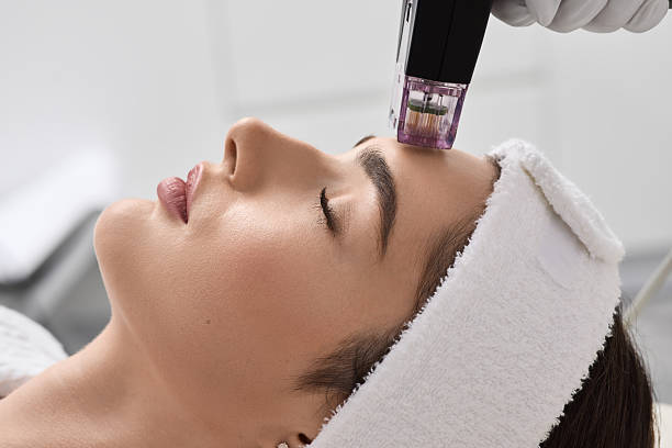 RF microneedling treatment in Izmir for skin tightening, acne scars and collagen stimulation performed by a dermatologist